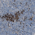 Immunohistochemical staining of human lymph node shows strong membranous and cytoplasmic positivity in non-germinal center cells.