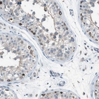 Immunohistochemical staining of human testis shows moderate membranous and cytoplasmic positivity in cells in seminiferous ducts.