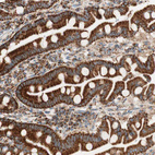 Immunohistochemical staining of human duodenum shows strong positivity in cytoplasm granular-cytoplasmic membranous in glandular cells.