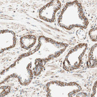 Immunohistochemical staining of human prostate shows strong positivity in cytoplasm granular-cytoplasmic membranous in glandular cells.