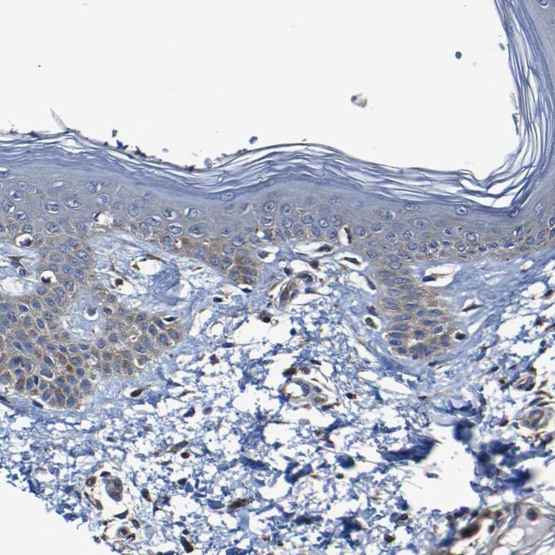 Anti-ADAM15 Antibody