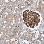 Anti-ST8SIA6 Antibody