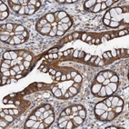 Immunohistochemical staining of human colon shows strong cytoplasmic positivity in glandular cells.