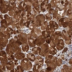 Immunohistochemical staining of human stomach shows strong cytoplasmic positivity in glandular cells.