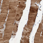 Immunohistochemical staining of human skeletal muscle shows strong cytoplasmic positivity in myocytes.
