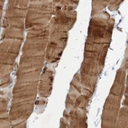 Immunohistochemical staining of human skeletal muscle shows strong cytoplasmic positivity in myocytes.