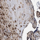 Immunohistochemical staining of human placenta shows strong cytoplasmic/membranous positivity in decidual cells, hoffbauer cells and trophoblastic cells.