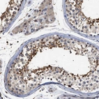 Immunohistochemical staining of human testis shows moderate cytoplasmic/membranous positivity in cells in seminiferous ducts and leydig cells.