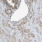 Immunohistochemical staining of human prostate shows moderate nuclear positivity in smooth muscle cells and glandular cells.