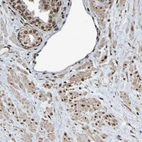 Immunohistochemical staining of human prostate shows moderate nuclear positivity in smooth muscle cells and glandular cells.