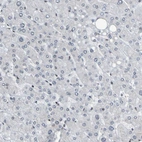 Immunohistochemical staining of human liver shows no positivity in hepatocytes as expected.