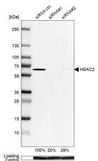 Western blot analysis in U-251MG cells transfected with control siRNA, target specific siRNA probe #1 and #2, using Anti-HDAC2 antibody. Remaining relative intensity is presented. Loading control: Anti-GAPDH.