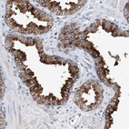 Anti-FIBP Antibody