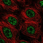 Immunofluorescent staining of human cell line MCF7 shows localization to nuclear speckles.