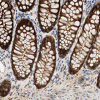 Anti-SELENBP1 Antibody