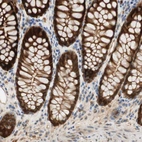 Immunohistochemical staining of human colon shows strong cytoplasmic positivity in glandular cells.
