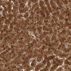 Immunohistochemical staining of human liver shows strong cytoplasmic and nuclear positivity in hepatocytes.