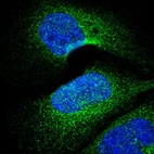 Anti-PARP4 Antibody