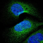 Immunofluorescent staining of human cell line U-2 OS shows localization to cytosol.