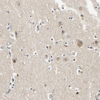 Immunohistochemical staining of human cerebral cortex shows moderate cytoplasmic and nuclear positivity in neurons.