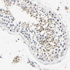 Immunohistochemical staining of human testis shows moderate nuclear and cytoplasmic positivity in cells in seminiferous ducts.