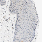 Immunohistochemical staining of human skin shows no positivity in squamous epithelial cells as expected.