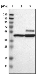 Lane 1: Marker [kDa] 230, 130, 95, 72, 56, 36, 28, 17, 11_br/_Lane 2: Human cell line RT-4_br/_Lane 3: Human cell line U-251MG sp