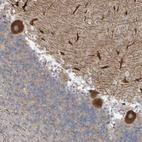 Anti-NAV2 Antibody