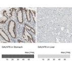 Anti-GALNT6 Antibody