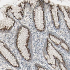 Immunohistochemical staining of human stomach shows high expression.