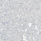Immunohistochemical staining of human liver shows low expression as expected.