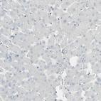 Anti-GALNT6 Antibody