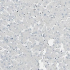 Immunohistochemical staining of human liver shows low expression as expected.