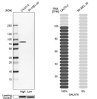 Western blot analysis in human cell lines Caco-2 and SK-MEL-30 using Anti-GALNT6 antibody. Corresponding GALNT6 RNA-seq data are presented for the same cell lines. Loading control: Anti-HDAC1.