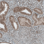 Immunohistochemical staining of human endometrium shows moderate nuclear positivity in glandular cells.