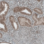 Immunohistochemical staining of human endometrium shows moderate nuclear positivity in glandular cells.