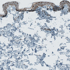 Immunohistochemical staining of human skin shows moderate to strong nuclear positivity in keratinocytes.