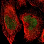 Immunofluorescent staining of human cell line A-431 shows localization to nucleus.