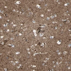 Anti-CNTNAP1 Antibody