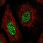 Immunofluorescent staining of human cell line HeLa shows localization to nucleoplasm.