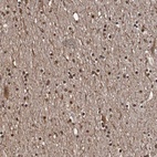 Immunohistochemical staining of human cerebral cortex shows high expression.