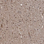Immunohistochemical staining of human cerebral cortex shows high expression.