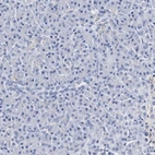 Immunohistochemical staining of human pancreas shows low expression as expected.