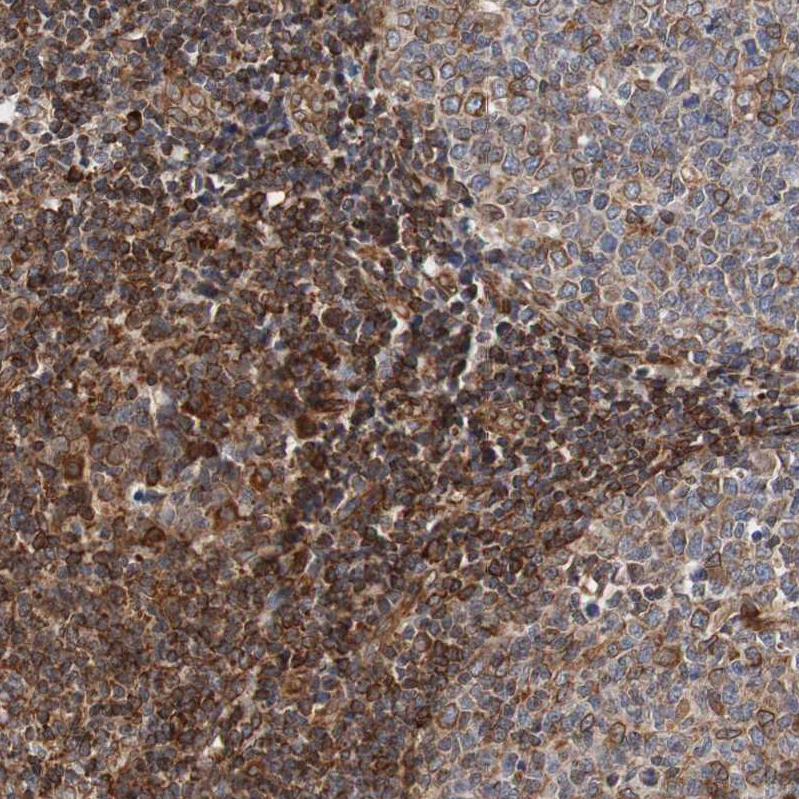 Anti-TMEM109 Antibody