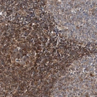 Anti-TMEM109 Antibody