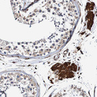 Immunohistochemical staining of human testis shows strong cytoplasmic positivity in Leydig cells.