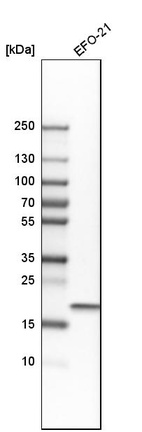 Western blot analysis in human cell line EFO-21.