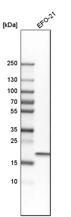 Western blot analysis in human cell line EFO-21.