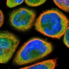Immunofluorescent staining of human cell line A-431 shows localization to nuclear membrane & cytosol.