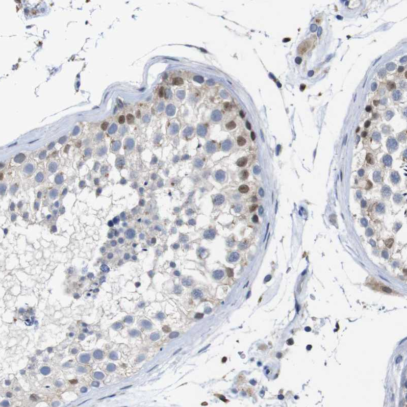 Anti-TCEAL9 Antibody